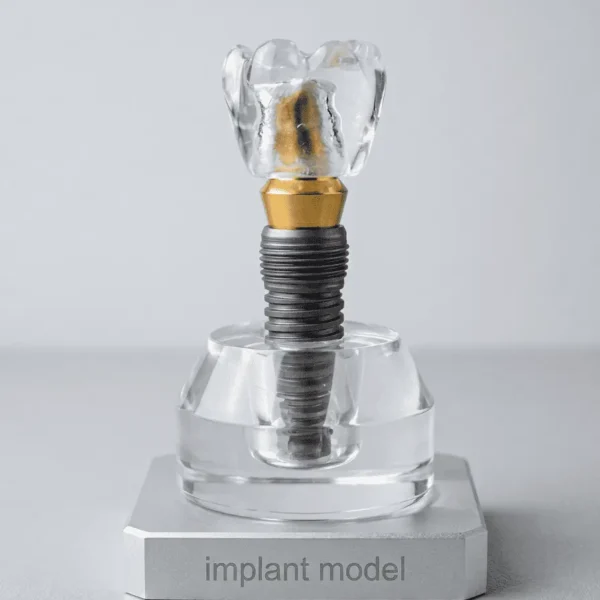 A top down professional view of a disassembled crystal dental implant model with a circular acrylic base, clear crown, and titanium finish screw on a sleek silver stand with a light gray background